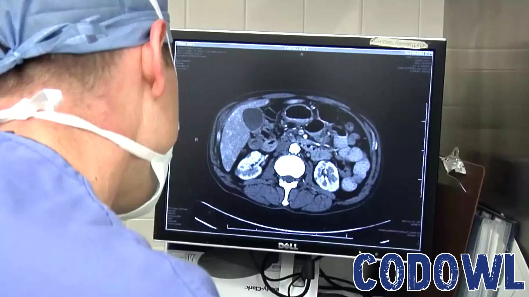 Innovative Glow-in-the-Dark Technology Aids in Cancer Cell Removal