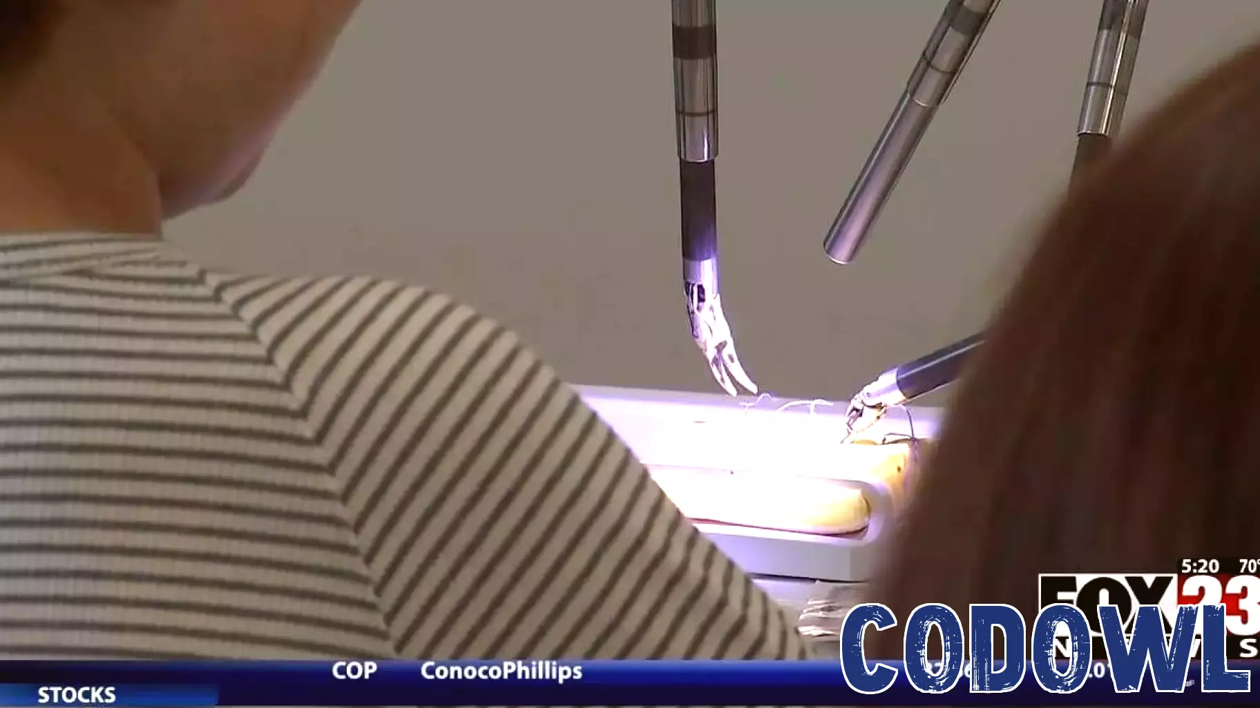 Innovative Technology Unveiled for Lung Cancer Treatment